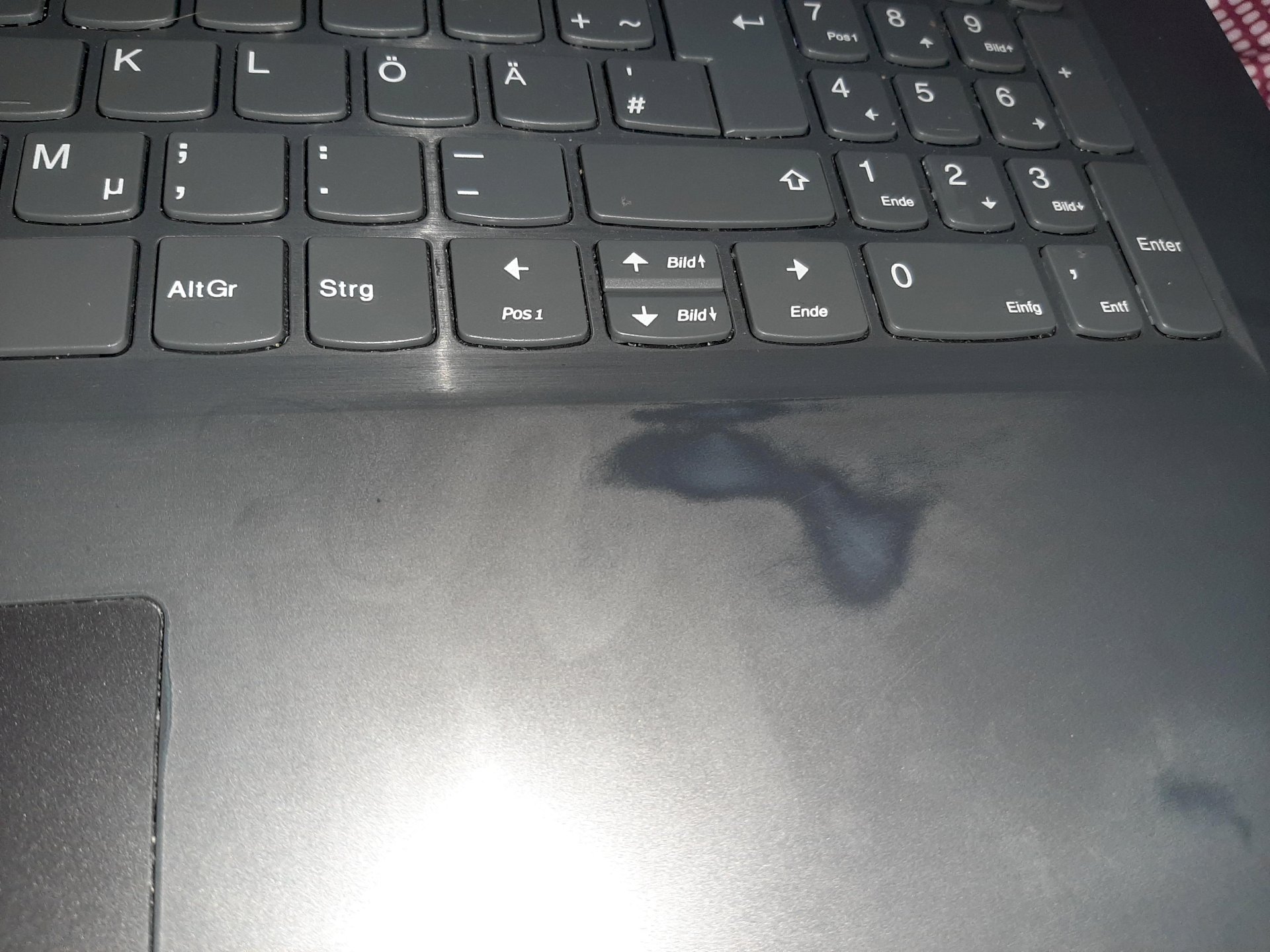 What kind of discoloration is it on my laptop