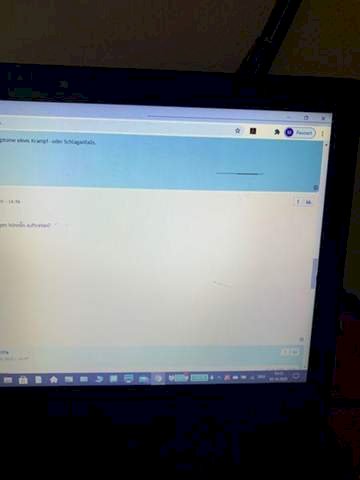 What are these stripes on my laptop display